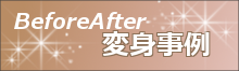 BeforeAfter変身事例バナー